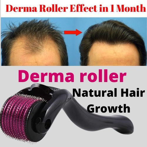 Dynamic Life Derma Roller